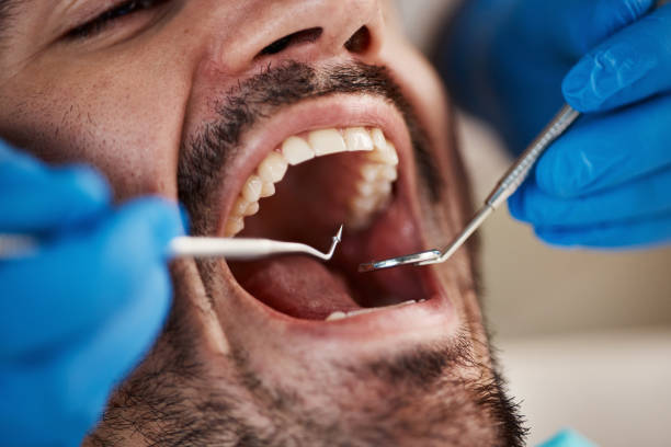 Best Emergency Gum Treatment in Corning, AR